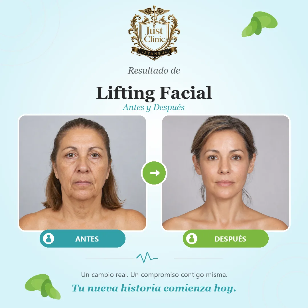 Facelift — Just Clinic Istanbul