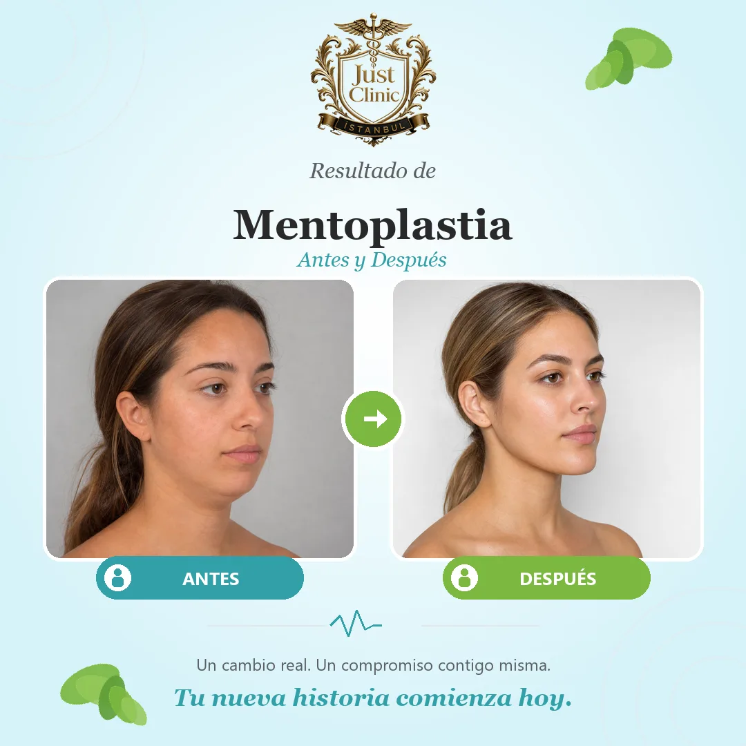 Chin surgery — Just Clinic Istanbul